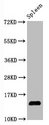 HIST1H2AB Antibody - Western Blot Positive WB detected in:Mouse spleen tissue All Lanes:Hydroxyl-Histone H2A type 1-B/E (Y39) antibody at 1.05µg/ml Secondary Goat polyclonal to rabbit IgG at 1/50000 dilution Predicted band size: 14 KDa Observed band size: 14 KDa