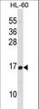 HIST1H2BD Antibody - HIST1H2BD Antibody western blot of HL-60 cell line lysates (35 ug/lane). The HIST1H2BD antibody detected the HIST1H2BD protein (arrow).
