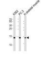 HIST1H2BM Antibody - Western blot of lysates from K562, PC-3 cell line and human skeletal muscle tissue lysate (from left to right) with HIST1H2BM Antibody. Antibody was diluted at 1:1000 at each lane. A goat anti-rabbit IgG H&L (HRP) at 1:5000 dilution was used as the secondary antibody. Lysates at 35 ug per lane.