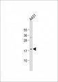 HIST1H3J Antibody - Anti-H3f3b Antibody (Center) at 1:2000 dilution + A431 whole cell lysate Lysates/proteins at 20 ug per lane. Secondary Goat Anti-Rabbit IgG, (H+L), Peroxidase conjugated at 1:10000 dilution. Predicted band size: 15 kDa. Blocking/Dilution buffer: 5% NFDM/TBST.