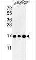 HIST3H3 Antibody - Western blot of HIST3H3 Antibody in CEM, K562, HL-60 cell line lysates (35 ug/lane). HIST3H3 (arrow) was detected using the purified antibody.
