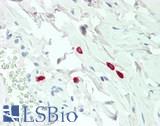 Histamine Antibody - Human Colon, Mast Cells: Formalin-Fixed, Paraffin-Embedded (FFPE)