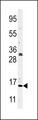 Antibody - Western blot of Histone H3 in CEM cell line lysates (35 ug/lane). Histone H3(arrow) was detected using the purified antibody.