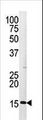 Antibody - Western blot of anti-Phospho-H3-pS28 antibody in HepG2 cell line lysate (35 ug/lane). Mouse Phospho-H3-pS28(arrow) was detected using the purified antibody.