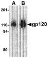 Antibody - Western blot of 1 mg of gp120 with gp120 antibody at (A) 0.5 and (B) 1 ug/ml.