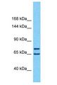 HIVEP1 / MBP-1 Antibody - HIVEP1 / MBP-1 antibody Western Blot of HepG2. Antibody dilution: 1 ug/ml.  This image was taken for the unconjugated form of this product. Other forms have not been tested.