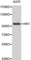 HK1 / Hexokinase 1 Antibody - Western blot of HK1 pAb in extracts from A375 cells.