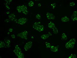 HK2 / Hexokinase 2 Antibody - Immunofluorescent staining of HepG2 cells using anti-HK2 mouse monoclonal antibody.