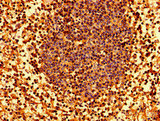 HLA Class I Histocompatibility Antigen, C-4 Alpha Chain Antibody - Immunohistochemistry image of paraffin-embedded human lymph node tissue at a dilution of 1:100