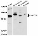 HLA-DOB Antibody - Western blot analysis of extracts of various cell lines, using HLA-DOB antibody at 1:3000 dilution. The secondary antibody used was an HRP Goat Anti-Rabbit IgG (H+L) at 1:10000 dilution. Lysates were loaded 25ug per lane and 3% nonfat dry milk in TBST was used for blocking. An ECL Kit was used for detection and the exposure time was 90s.