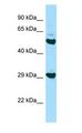 HLA-DOB Antibody - HLA-DOB antibody Western Blot of HepG2. Antibody dilution: 1 ug/ml.  This image was taken for the unconjugated form of this product. Other forms have not been tested.