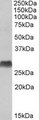 HLA-DQA2 Antibody - HLA-DQA2 antibody (1 ug/ml) staining of Human Bone Marrow lysate (35 ug protein/ml in RIPA buffer). Primary incubation was 1 hour. Detected by chemiluminescence.