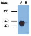 HLA-DR1 Antibody - Western blotting analysis of HLA-DR1 in Raji (A) and Jurkat (B) cell lines using MEM-267 antibody.
