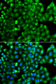 HLA-DRB1 Antibody - Immunofluorescence analysis of A549 cells.