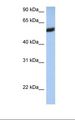 HLA-F Antibody - 721_B cell lysate. Antibody concentration: 1.0 ug/ml. Gel concentration: 12%.  This image was taken for the unconjugated form of this product. Other forms have not been tested.