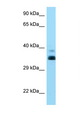 HLA-G Antibody - HLA-G antibody Western blot of 8226 Cell lysate. Antibody concentration 1 ug/ml.  This image was taken for the unconjugated form of this product. Other forms have not been tested.