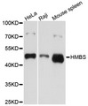 HMBS / PBGD Antibody - Western blot analysis of extracts of various cell lines, using HMBS antibody at 1:1000 dilution. The secondary antibody used was an HRP Goat Anti-Rabbit IgG (H+L) at 1:10000 dilution. Lysates were loaded 25ug per lane and 3% nonfat dry milk in TBST was used for blocking. An ECL Kit was used for detection and the exposure time was 5s.