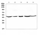 HMBS / PBGD Antibody - Western blot analysis of HMBS using anti-HMBS antibody. Electrophoresis was performed on a 5-20% SDS-PAGE gel at 70V (Stacking gel) / 90V (Resolving gel) for 2-3 hours. The sample well of each lane was loaded with 50ug of sample under reducing conditions. Lane 1: human Hela whole cell lysates,Lane 2: human placenta tissue lysates,Lane 3: human HepG2 whole cell lysates,Lane 4: human 22RV1 whole cell lysates,Lane 5: human U20S whole cell lysates. After Electrophoresis, proteins were transferred to a Nitrocellulose membrane at 150mA for 50-90 minutes. Blocked the membrane with 5% Non-fat Milk/ TBS for 1.5 hour at RT. The membrane was incubated with rabbit anti-HMBS antigen affinity purified polyclonal antibody at 0.5 µg/mL overnight at 4°C, then washed with TBS-0.1% Tween 3 times with 5 minutes each and probed with a goat anti-rabbit IgG-HRP secondary antibody at a dilution of 1:10000 for 1.5 hour at RT. The signal is developed using an Enhanced Chemiluminescent detection (ECL) kit with Tanon 5200 system. A specific band was detected for HMBS at approximately 45KD. The expected band size for HMBS is at 39KD.