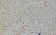HMG-CoA Reductase / HMGCR Antibody - 1:100 staining human gastric tissue by IHC-P. The sample was formaldehyde fixed and a heat mediated antigen retrieval step in citrate buffer was performed. The sample was then blocked and incubated with the antibody for 1.5 hours at 22°C. An HRP conjugated goat anti-rabbit antibody was used as the secondary.