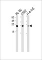 HMG2 / HMGB2 Antibody - HMGB2 Antibody western blot of HL-60,K562,H-4-II-E cell line lysates (35 ug/lane). The HMGB2 antibody detected the HMGB2 protein (arrow).