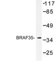 HMG20B / BRAF35 Antibody - Western blot of BRAF35 (T29) pAb in extracts from Jurkat cells.