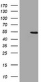 HMG2L1 / HMGXB4 Antibody - HEK293T cells were transfected with the pCMV6-ENTRY control (Left lane) or pCMV6-ENTRY HMGXB4 (Right lane) cDNA for 48 hrs and lysed. Equivalent amounts of cell lysates (5 ug per lane) were separated by SDS-PAGE and immunoblotted with anti-HMGXB4.
