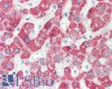 HMGCS2 / HMG-CoA Synthase 2 Antibody - Anti-HMGCS2 antibody IHC staining of human liver. Immunohistochemistry of formalin-fixed, paraffin-embedded tissue after heat-induced antigen retrieval.  This image was taken for the unconjugated form of this product. Other forms have not been tested.