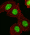 HMGIY / HMGA1 Antibody - Fluorescent image of A549 cell stained with HMGA1 Antibody. A549 cells were fixed with 4% PFA (20 min), permeabilized with Triton X-100 (0.1%, 10 min), then incubated with HMGA1 primary antibody (1:25, 1 h at 37°C). For secondary antibody, Alexa Fluor 488 conjugated donkey anti-rabbit antibody (green) was used (1:400, 50 min at 37°C). Cytoplasmic actin was counterstained with Alexa Fluor 555 (red) conjugated Phalloidin (7units/ml, 1 h at 37°C). HMGA1 immunoreactivity is localized to Nucleus significantly.