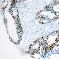 HMGN2 Antibody - Immunohistochemical analysis of HMGN2 staining in human colon formalin fixed paraffin embedded tissue section. The section was pre-treated using heat mediated antigen retrieval with sodium citrate buffer (pH 6.0). The section was then incubated with the antibody at room temperature and detected using an HRP conjugated compact polymer system. DAB was used as the chromogen. The section was then counterstained with hematoxylin and mounted with DPX.