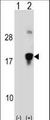 HMGN3 Antibody - Western blot of HMGN3 (arrow) using rabbit polyclonal HMGN3 Antibody. 293 cell lysates (2 ug/lane) either nontransfected (Lane 1) or transiently transfected (Lane 2) with the HMGN3 gene.