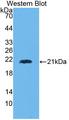 HMMR / CD168 / RHAMM Antibody - Western blot of HMMR / CD168 / RHAMM antibody.