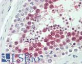 HMMR / CD168 / RHAMM Antibody - Human Testis: Formalin-Fixed, Paraffin-Embedded (FFPE)