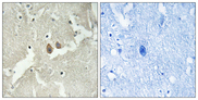 HMP19 Antibody - Immunohistochemistry analysis of paraffin-embedded human brain tissue, using NSG2 Antibody. The picture on the right is blocked with the synthesized peptide.