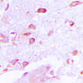 HMP19 Antibody - Immunohistochemical analysis of NSG2 staining in human brain formalin fixed paraffin embedded tissue section. The section was pre-treated using heat mediated antigen retrieval with sodium citrate buffer (pH 6.0). The section was then incubated with the antibody at room temperature and detected using an HRP conjugated compact polymer system. DAB was used as the chromogen. The section was then counterstained with hematoxylin and mounted with DPX.