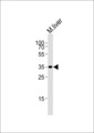 HMX2 Antibody - Western blot of lysate from mouse liver tissue lysate, using Hmx2 Antibody. Antibody was diluted at 1:1000. A goat anti-rabbit IgG H&L (HRP) at 1:10000 dilution was used as the secondary antibody. Lysate at 20ug.