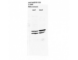 hnRNP F + H Antibody - Western blot of HNRNPF/H antibody.