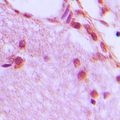 Antibody - Immunohistochemical analysis of hnRNP H staining in human brain formalin fixed paraffin embedded tissue section. The section was pre-treated using heat mediated antigen retrieval with sodium citrate buffer (pH 6.0). The section was then incubated with the antibody at room temperature and detected using an HRP conjugated compact polymer system. DAB was used as the chromogen. The section was then counterstained with hematoxylin and mounted with DPX.
