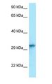 HNRNPC / HNRNP C Antibody - HNRNPC / HNRNP C antibody Western Blot of Mouse Lung.  This image was taken for the unconjugated form of this product. Other forms have not been tested.
