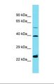 HNRNPC / HNRNP C Antibody - Western blot of U937. HSD11B1L antibody dilution 1.0 ug/ml.  This image was taken for the unconjugated form of this product. Other forms have not been tested.