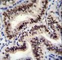 HNRNPCL1 Antibody - HNRNPCL1 Antibody immunohistochemistry of formalin-fixed and paraffin-embedded human uterus tissue followed by peroxidase-conjugated secondary antibody and DAB staining.