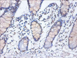 HNRNPD / AUF1 Antibody - Immunohistochemistry of paraffin-embedded human small intestine tissue using HNRNPD Antibody at dilution of 1:100