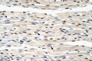 HNRNPDL / hnRNP D Antibody - HNRPDL antibody ARP40585_T100-EAX05890-HNRPDL (heterogeneous nuclear ribonucleoprotein D-like) Antibody IHC of formalin-fixed, paraffin-embedded human Muscle. Positive label: Skeletal muscle cells indicated with arrows. Antibody concentration 4-8 ug/ml. Magnification 400X.  This image was taken for the unconjugated form of this product. Other forms have not been tested.