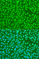 HNRNPDL / hnRNP D Antibody - Immunofluorescence analysis of U2OS cells using HNRNPDL antibodyat dilution of 1:100. Blue: DAPI for nuclear staining.