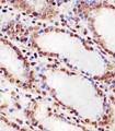 HNRNPUL2 Antibody - Antibody staining HNRNPUL2 in human stomach tissue sections by Immunohistochemistry (IHC-P - paraformaldehyde-fixed, paraffin-embedded sections). Tissue was fixed with formaldehyde and blocked with 3% BSA for 0. 5 hour at room temperature; antigen retrieval was by heat mediation with a citrate buffer (pH 6). Samples were incubated with primary antibody (1:25) for 1 hours at 37°C. A undiluted biotinylated goat polyvalent antibody was used as the secondary antibody.