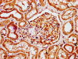 HOGA1 Antibody - Immunohistochemistry Dilution at 1:300 and staining in paraffin-embedded human kidney tissue performed on a Leica BondTM system. After dewaxing and hydration, antigen retrieval was mediated by high pressure in a citrate buffer (pH 6.0). Section was blocked with 10% normal Goat serum 30min at RT. Then primary antibody (1% BSA) was incubated at 4°C overnight. The primary is detected by a biotinylated Secondary antibody and visualized using an HRP conjugated SP system.