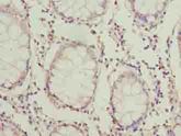 HOOK1 Antibody - Immunohistochemistry of paraffin-embedded human colon cancer using antibody at dilution of 1:100.