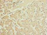 HOOK2 Antibody - Immunohistochemistry of paraffin-embedded human liver tissue at dilution of 1:100