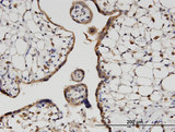 HOOK3 Antibody - Immunoperoxidase of monoclonal antibody to HOOK3 on formalin-fixed paraffin-embedded human placenta. [antibody concentration 3 ug/ml]