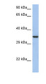 HORMAD2 Antibody - HORMAD2 antibody Western blot of HT1080 cell lysate. This image was taken for the unconjugated form of this product. Other forms have not been tested.