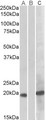 HOXA1 Antibody - HEK293 lysate (10ug protein in RIPA buffer) overexpressing Human HOXA1 (RC222721) with C-terminal MYC tag probed with (1ug/ml) in Lane A and probed with anti-MYC Tag (1/1000) in lane C. Mock-transfected HEK293 probed (1mg/ml) in Lane